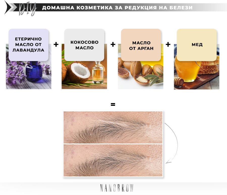 DIY - ДОМАШНА КОЗМЕТИКА ЗА РЕДУКЦИЯ НА БЕЛЕЗИ: ЕТЕРИЧНО МАСЛО ОТ ЛАВАНДУЛА + КОКОСОВО МАСЛО + МАСЛО ОТ АРГАН + МЕД = свиване на белега!